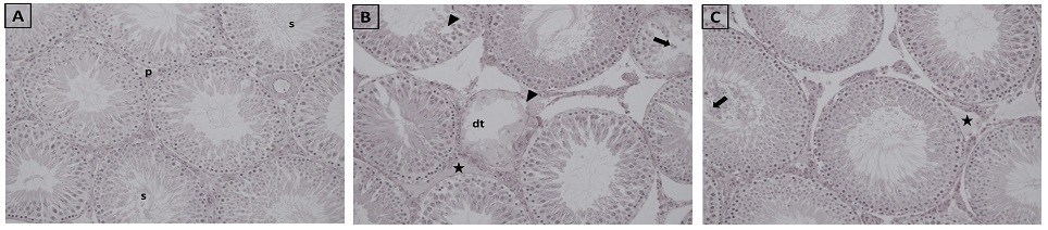 Histopathological images of testicular tissues of groups
(×200, H&E staining). Control Group (A) P: normal peritubular tissue,
S: spermatozoon in the lumen of the seminiferous tubule. T/D Group (B) DT:
degenerative seminiferous tubule structure, black arrow: spilled immature
germinal cells into the lumen of the seminiferous tubule, arrowhead:
vacuolization in tubule epithelium, black star: edema in peritubular tissue. T/D
+ GA Group (C) Black arrow: spilled immature germinal cells into the lumen of the
seminiferous tubule, black star: edema in peritubular tissue.