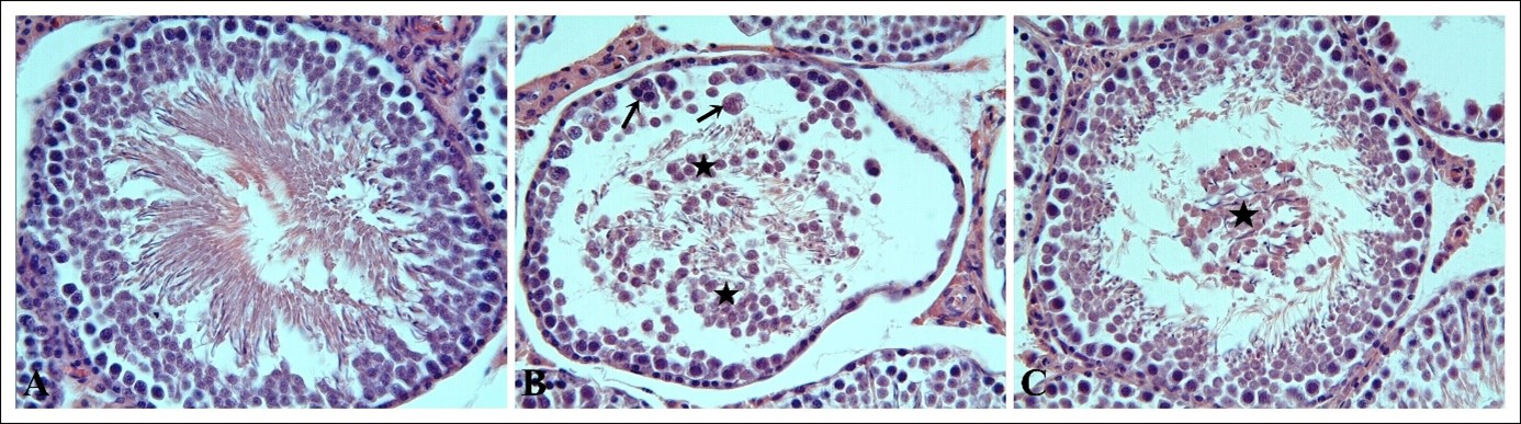 Histopathological changes. The sham (A), seminiferous
tubule is normal histological appearance. The TTD group (B), multi-nucleated
giant cell formation in the seminiferous epithelium (arrows) and spilling of
immature germ cells in the lumen seminiferous tubule (asteriks) are showed. The
ASTX + TTD group (C), it is noteworthy that the histopathological changes are
significantly alleviated. H&E staining ×400.