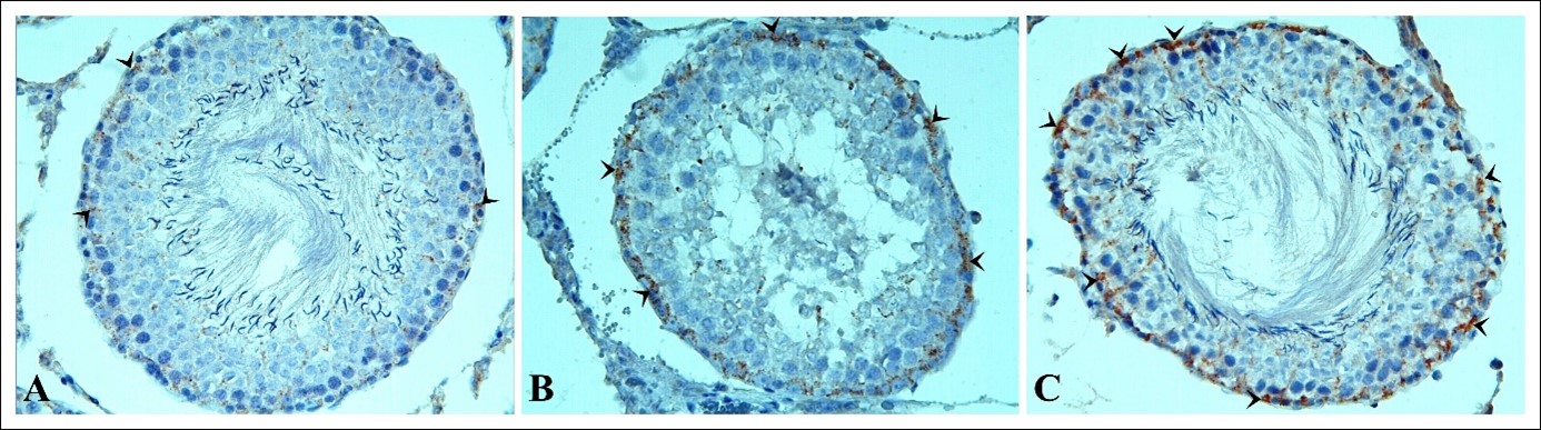 Beclin-1 immunoreactivity. Beclin-1 immunoreactivity is
observed in sham group (A). In TTD group (C), a increase in Beclin-1
immunoreactivity (arrowheads) is noticed. Significantly higher Beclin-1
immunoreactivity is observed in the ASTX + TTD group (C) compared to the sham and
TTD groups.