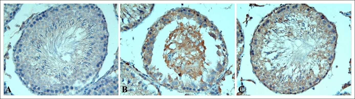 Slight caspase-3 immunoreactivity. Slight caspase-3
immunoreactivity is observed in sham group (A). In TTD group (C), a increase in
caspase-3 immunoreactivity is noticed. On the other hand, a mild decrease in
caspase immunoreactivity is showed in the ASTX + TTD group (C) compared with TTD
group. Caspase-3 immunostaining ×400.