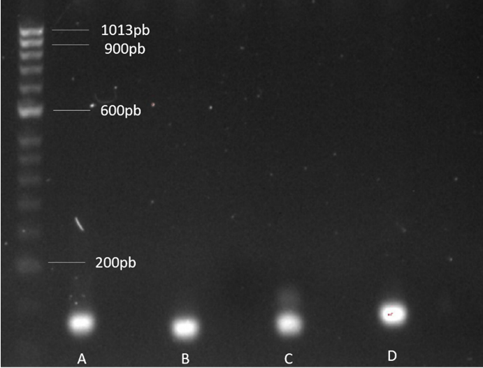 Electroforesis de controles positivos y negativos de
microorganismos. A. Atopobium vaginae (155 pares de bases-pb-); B.
Gardnerella vaginalis (139 pb); C. L. crispatus (145 pb); D.
L. iners (166 pb).
