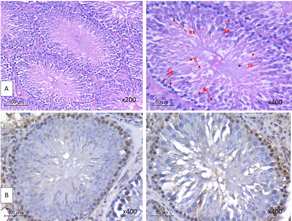 Control group showing. (A) normal tubular diameter, epithelial
height and Jhonson score. (B) with low HMGB-1 and NLRP3. Sg: spermatogonia, Se:
Sertoli cell, Sc: spermatocyte, es: elongated spermatid, rs: round spermatid, s:
spermatozoa.