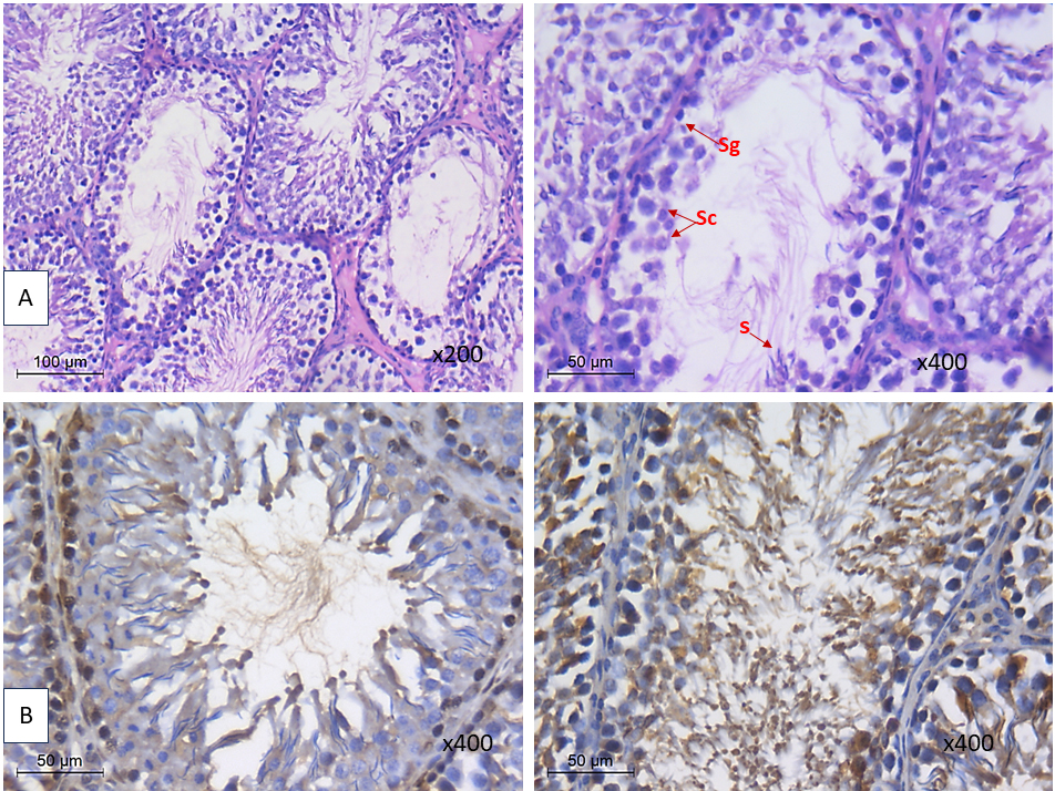 HFD-zinc sulphate fed group showing. (A) increased tubular
diameter, epithelial height and Jhonson score with (B) decreased HMGB-1 and
NLRP3. Sg: spermatogonia, Sc: spermatocyte, s: spermatozoa.