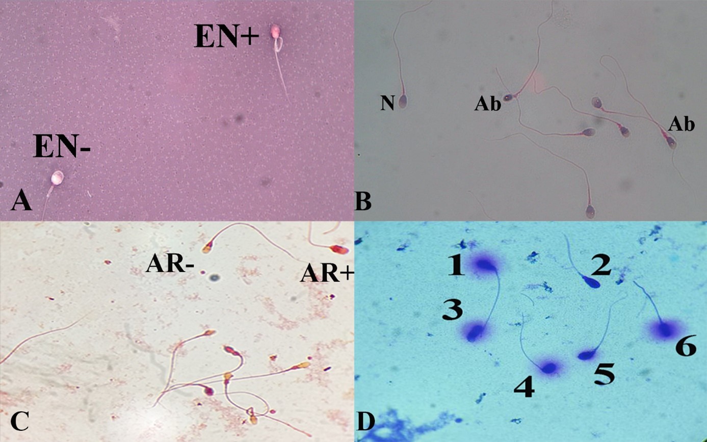 Evaluation of sperm viability, morphology, acrosome reaction and
DNA fragmentation. (A) Sperm viability using eosin-nigrosin staining method,
live (unstained) cell (EN−), dead (red) cell (EN+); (B) Sperm morphology using
Papanicolaou staining, N: Normal, Ab: Abnormal; (C) Double staining test for
evaluation of acrosome reaction, Cells with acrosome reaction (AR+), cell with
intact acrosome (AR−); (D) Sperm chromatin dispersion test to evaluate sperm DNA
fragmentation, 1: Normal cell with large halo, 2: Abnormal cell without halo,
3,4: Normal cell with medium halo, 5: Abnormal cell with small halo, 6: Normal
cell with large halo (1000×).