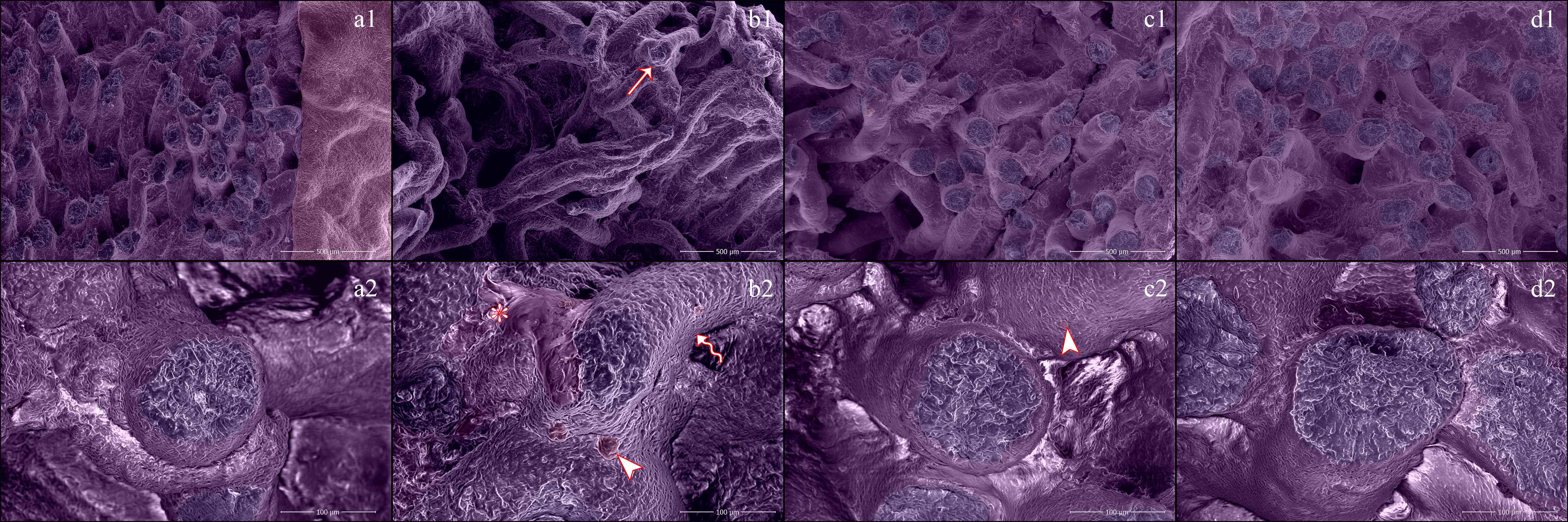 Scanning electron micrographs of Control (a1 & a2), I/R (b1 & b2), I/R + t100 (c1 & c2), and I/R + t200 (d1 & d2) groups. Severe
tubular degenerations and irregularity in seminiferous tubule (arrow),
interstitial edema with erythrocytes (asterisk), cellular debris (arrowhead),
irregularity on basement membrane (curved arrow). Bar: 500 µm (a1,
b1, c1, d1), 100 µm (a2, b2, c2, d2).