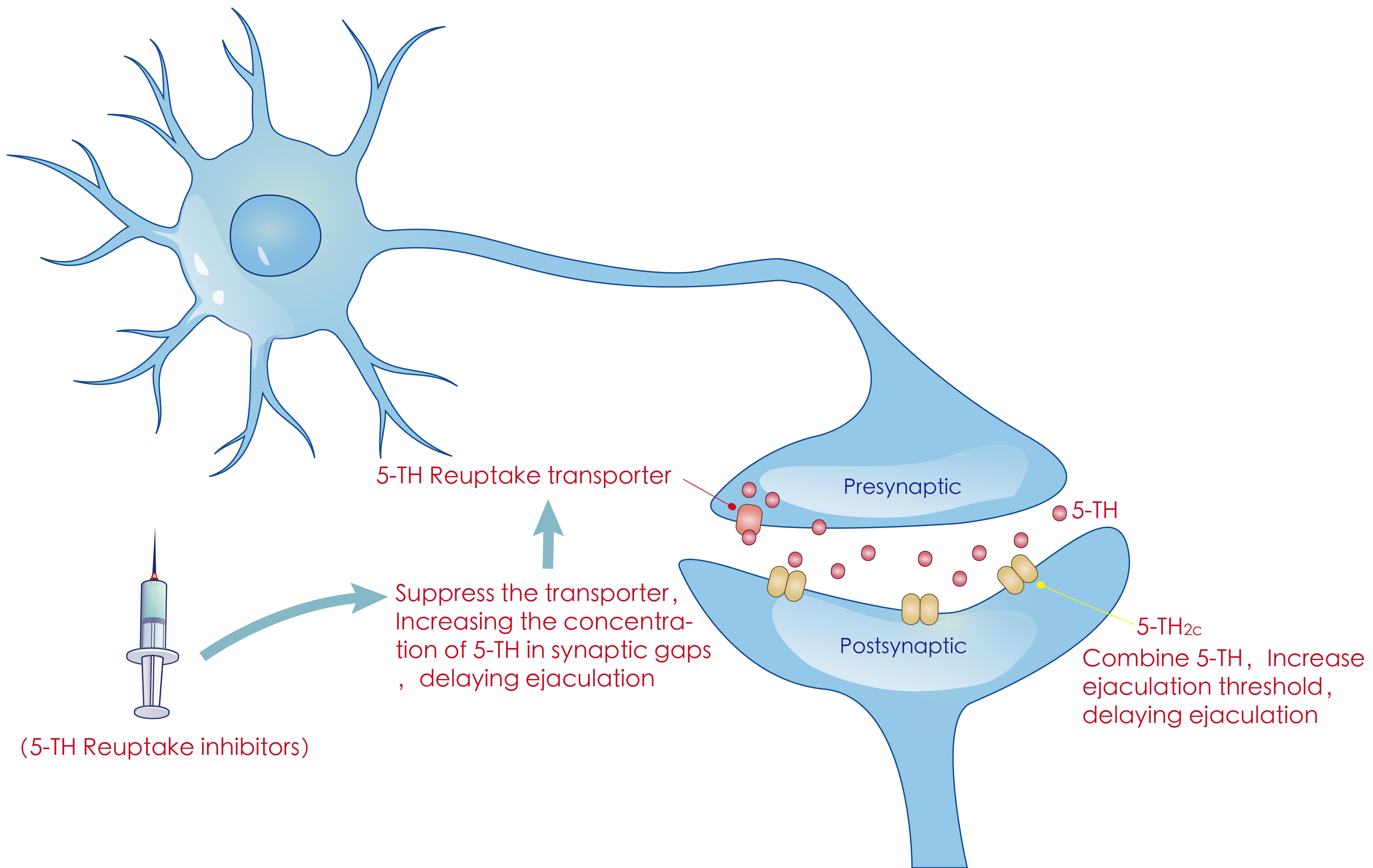 The figure shows the use of 5-TH reuptake inhibitors to inhibit
transporters and increase the concentration of 5-TH in the synaptic cleft, which
increases ejaculation threshold and delays ejaculation. 5-TH:
5-hydroxytryptamine.