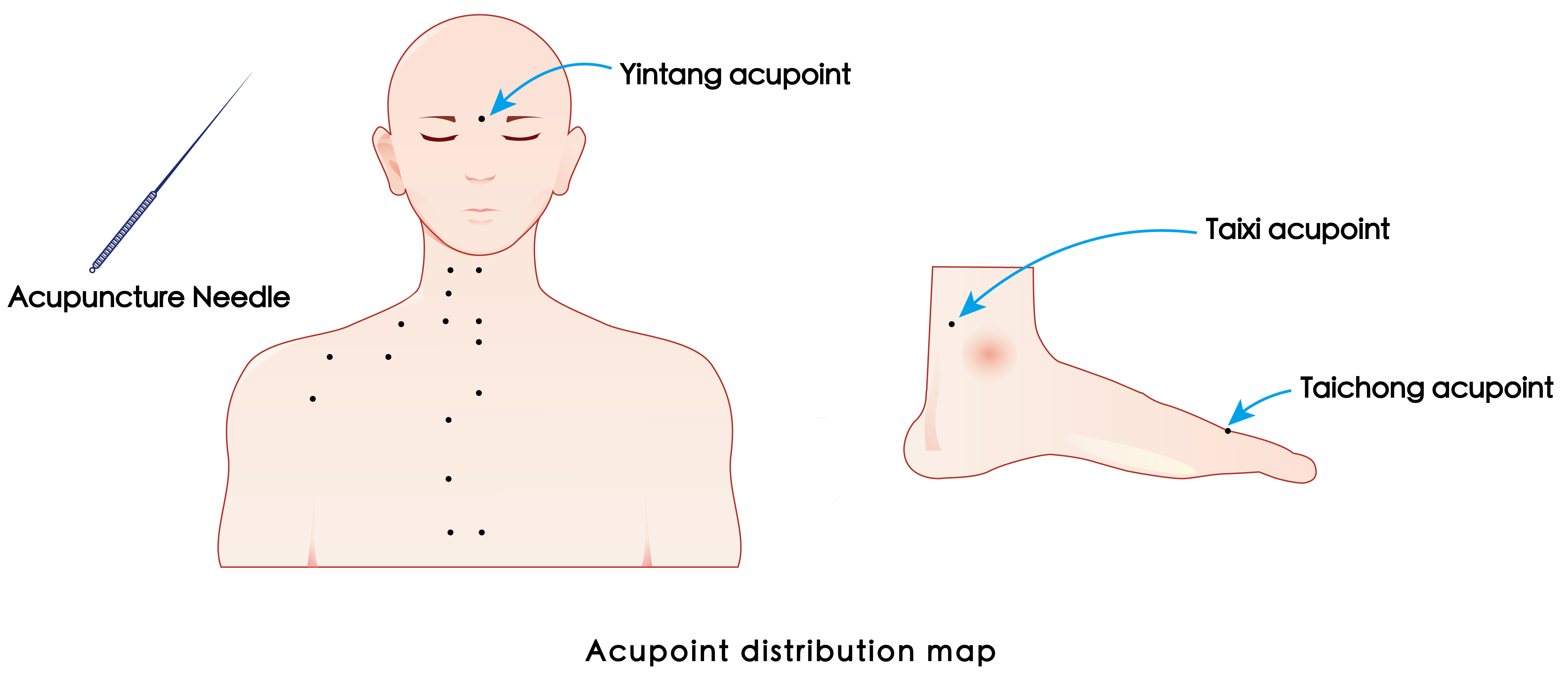 The figure shows the distribution of acupoints such as Taixi,
Taichong and Yintang.