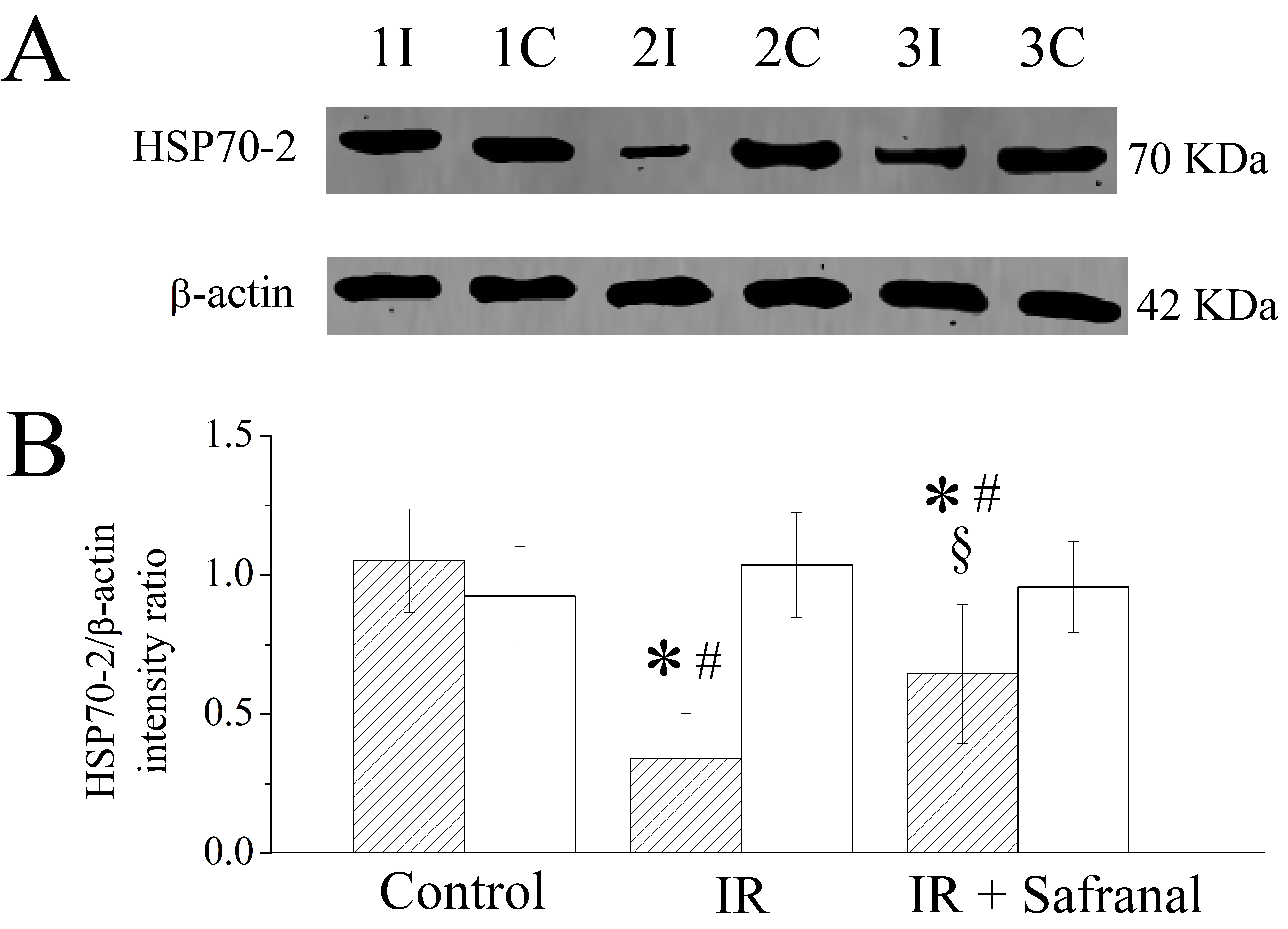 Effects of testicular ischemia-reperfusion (IR) and safranal
therapy on the expression of heat shock protein 70-2 (HSP70-2) in testicular
tissue. (A) Representative Western blot images of HSP70-2 and β-actin
(internal standard) in bilateral testes from rats in the control, IR and
safranal-treated groups. Lanes 1I and 1C correspond to ipsilateral and
contralateral testes in control group. Lanes 2I and 2C correspond to ipsilateral
and contralateral testes in IR group. Lanes 3I and 3C correspond to ipsilateral
and contralateral testes in the safranal-treated group. (B) The intensity ratio
of the HSP70-2 band to the β-actin band from the same tissue sample
manifests a relative expression of the HSP70-2 protein level. Hatched histograms
represent ipsilateral testes; open histograms represent contralateral testes.
Results are shown as mean ± standard deviation of ten independent
observations. Pairwise comparisons of the three groups were conducted using the
one-way analysis of variance and Student-Newman-Keuls post hoc test. A
two-sided t-test was used to compare the differences between the
ipsilateral and contralateral testes within the group. *p < 0.001:
compared to the control group; #p < 0.01: compared to
contralateral testes in the same group; §p < 0.01:
compared to ipsilateral testes in the IR group.
