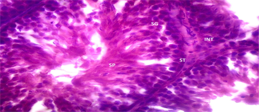 Histopathological image of group A testicular tissue treated
with distilled water only (H&E), ×400. The testis
photomicrograph illustrates a normal and well-organized histoarchitecture. Within
each seminiferous tubule, there is a visible pool of dividing spermatogonia (SG),
which are the germ cells responsible for initiating spermatogenesis. These cells
are situated near the basal membrane of the tubule and represent the earliest
stage in the development of sperm. As spermatogenesis progresses, these
spermatogonia mature and move towards the lumen of the tubule, ultimately
differentiating into fully developed spermatozoa (SP), which are present in the
central lumen of the tubule. In the spaces between the seminiferous tubules, the
interstitial cells (INT), or Leydig cells, are clearly visible. These cells are
strategically located in the interstitial tissue and play a crucial role in
producing testosterone. The overall structure depicted in this photomicrograph
reflects a healthy testicular environment, where the processes of germ cell
development and hormone production are functioning normally. The arrangement of
the spermatogonia, maturing spermatozoa, and interstitial cells suggests that the
testicular tissue is structurally intact and capable of supporting regular sperm
production. ST: seminiferous tubule.