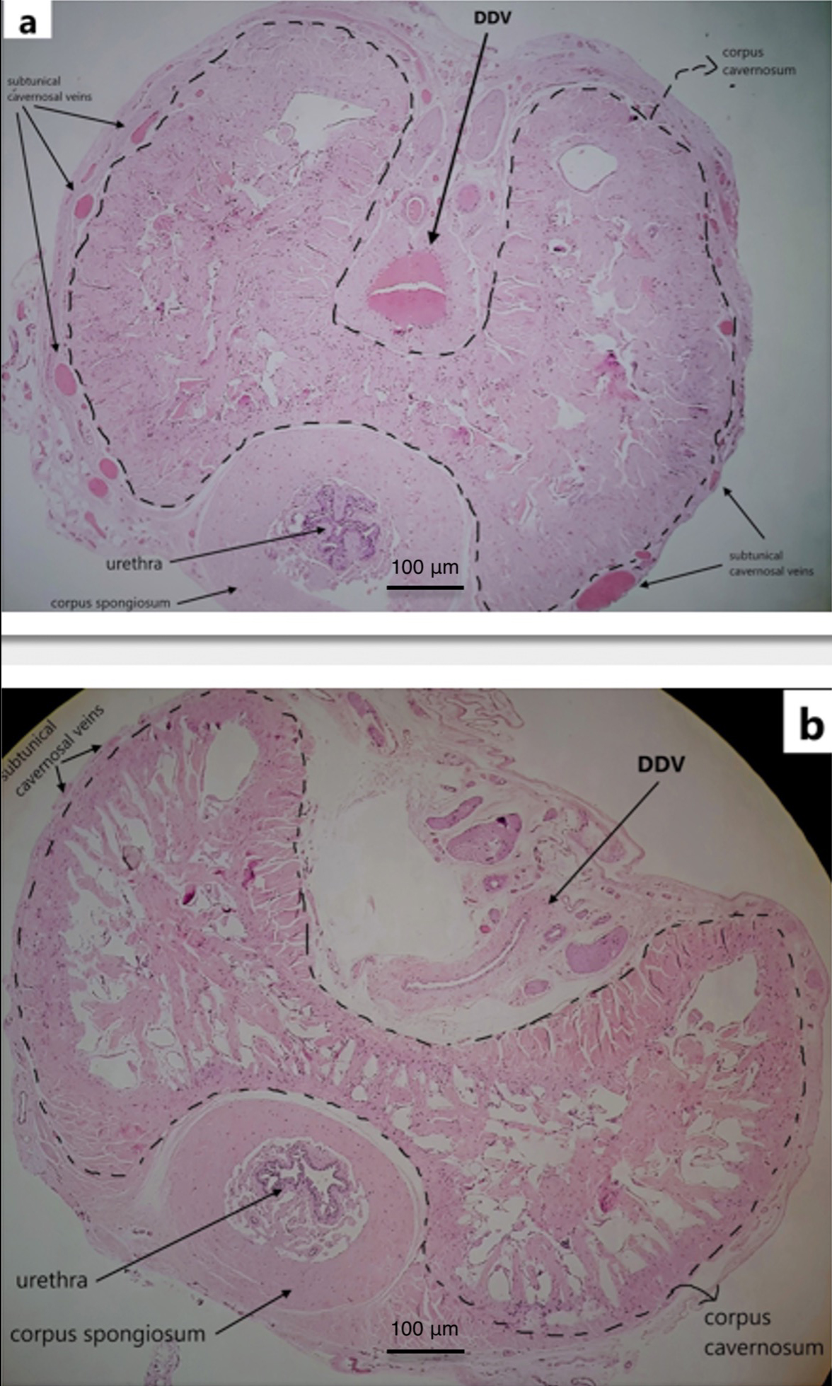 Microscopic examination of the penis without (a) and
with Artificial Erection (b). (a) Significant congestion in the dorsal vein and
other venous structures in the non-erectile tissue (H&E, ×4
magnification). (b) Dilated corpus cavernosum, significantly decreased blood flow
and collapse in the dorsal vein and other venous structures in the erectile
tissue H&E, ×4 magnification (scale bar = 100 μm) Deep Dorsal
Vein (DDV).