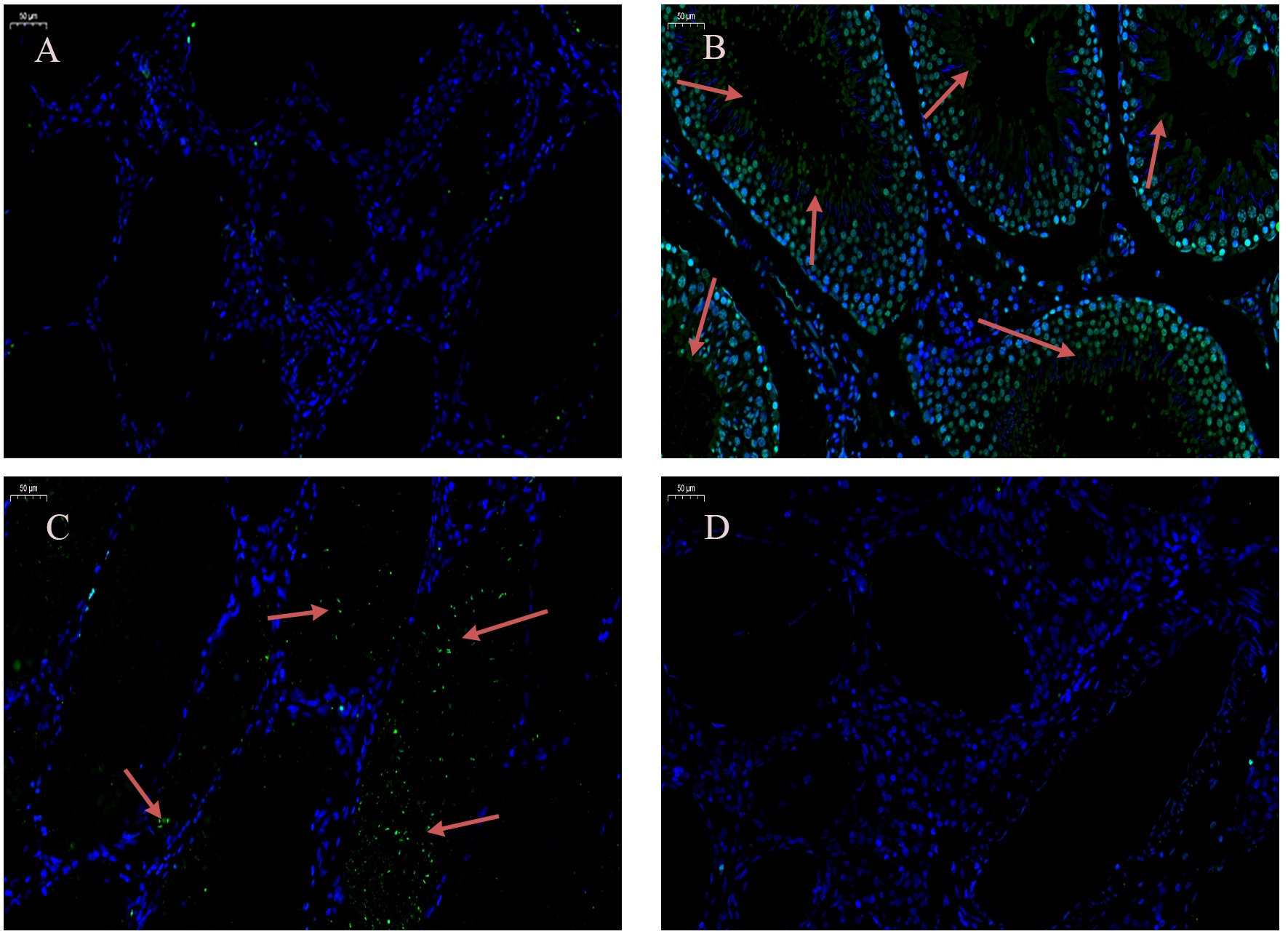 TUNEL assay of testis-tissue apoptosis. Rats were treated with
CdCl2 and/or Que for 4 weeks. Positive apoptotic cells are green (red
arrows, 40×). (A) control group, (B) 2 mg/kg b.w.
CdCl2 treatment group, (C) 2 mg/kg b.w. CdCl2
+ 100 mg/kg b.w. Que co-treatment group, (D)
100 mg/kg b.w. Que co-treatment group.