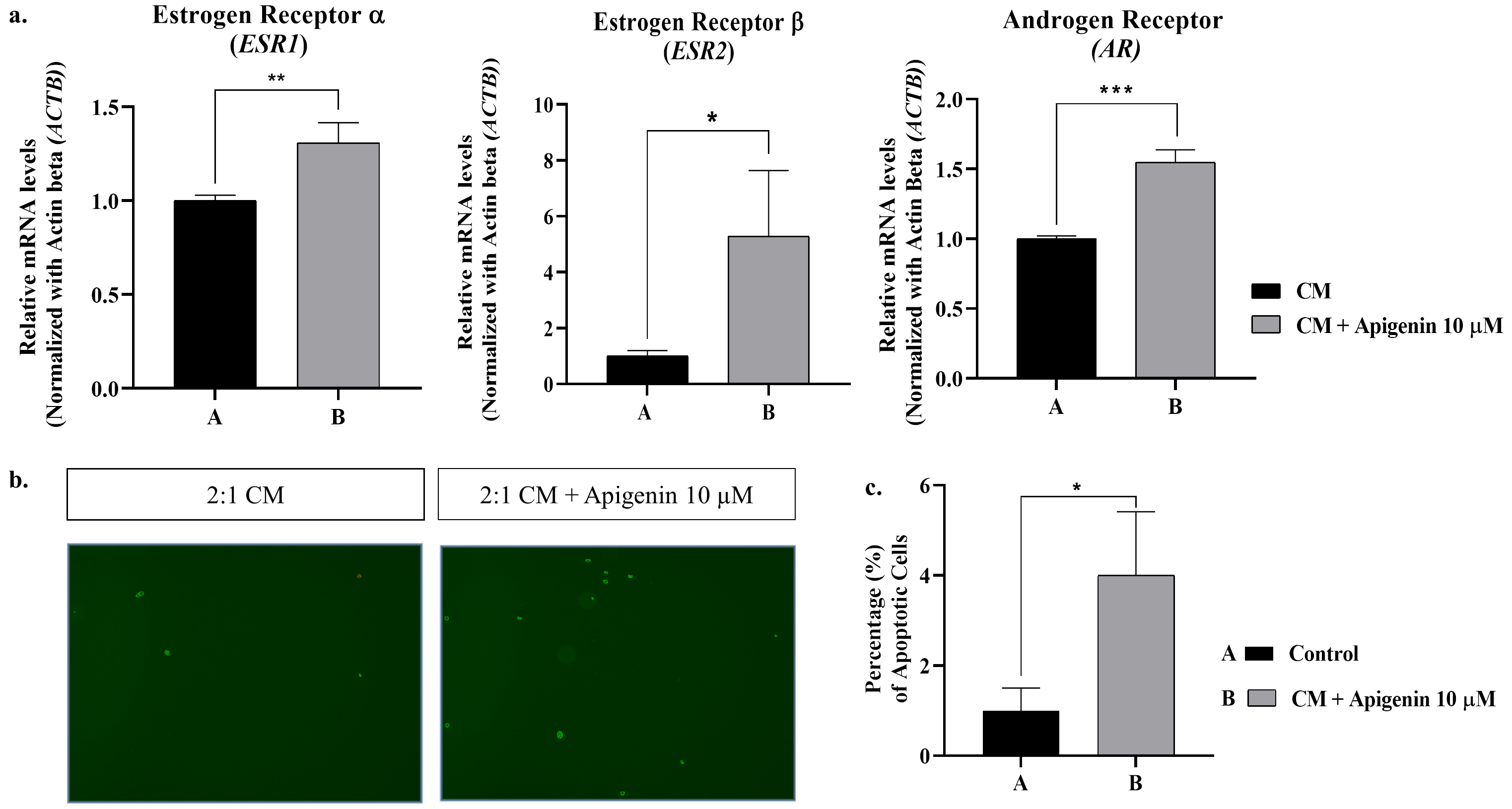 Effect of apigenin at the molecular level in prostate epithelial 
cells. (a) Relative gene expression of ESR1(ERα), ESR2 
(Erβ) and AR. data are shown as mean ± SEM (standard error 
of the mean). ***p < 0.001, **p < 0.01, *p < 
0.05 compared to control group (n = 3); (b) Representative images showing 
caspase-3/7 positive cells detected by cell counter; (c) Quantification of 
caspase-3/7 positive cells. Data are shown as mean ± SD. *p < 
0.05 compared to the 2:1 CM group (n = 3). mRNA: Messenger RNA; CM: conditioned 
medium.