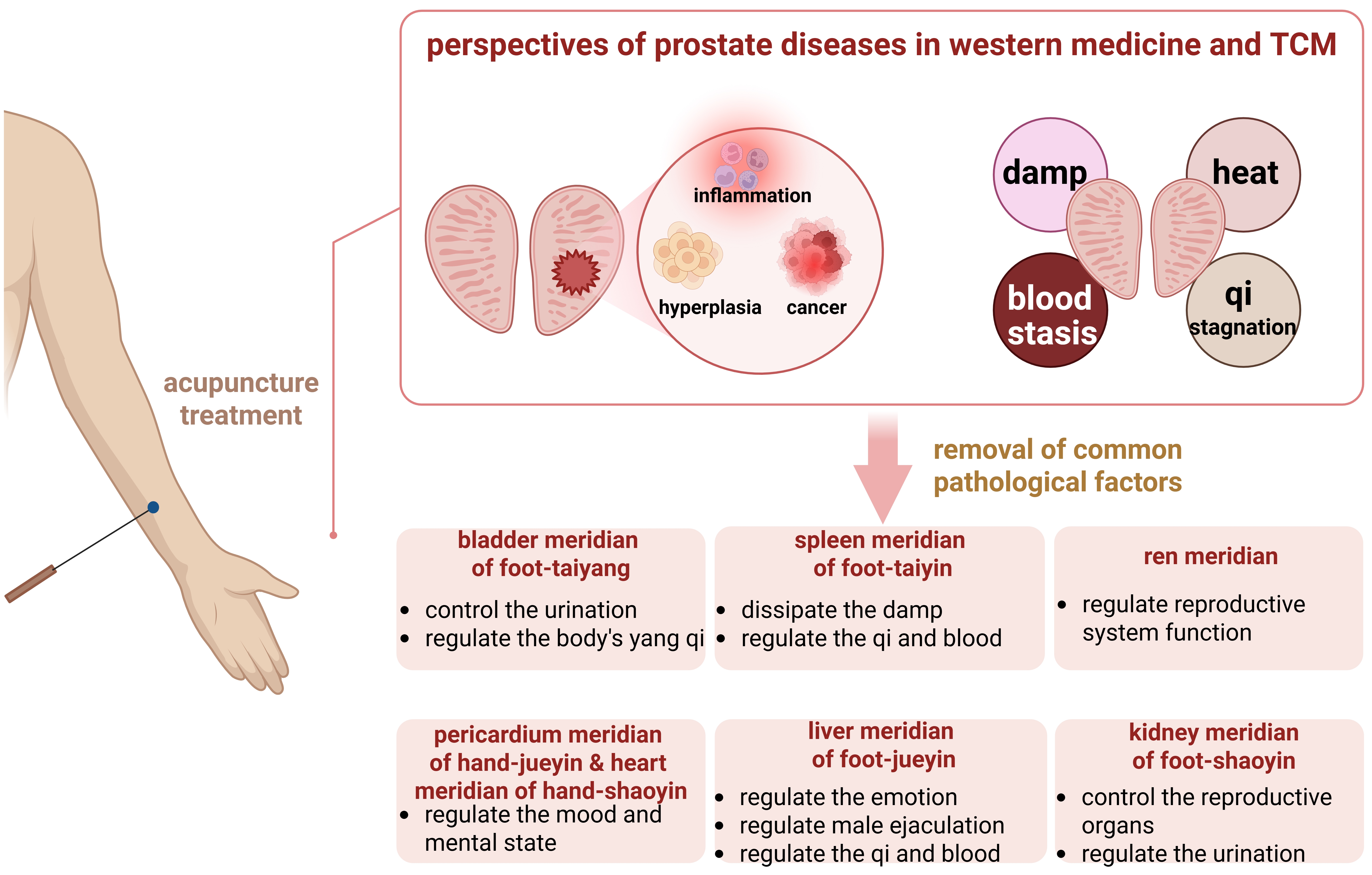 TCM views of acupuncture therapy in prostate diseases. (Created
in BioRender. Wang, H. (2025)
https://BioRender.com/d27d688). TCM:
traditional Chinese medicine.