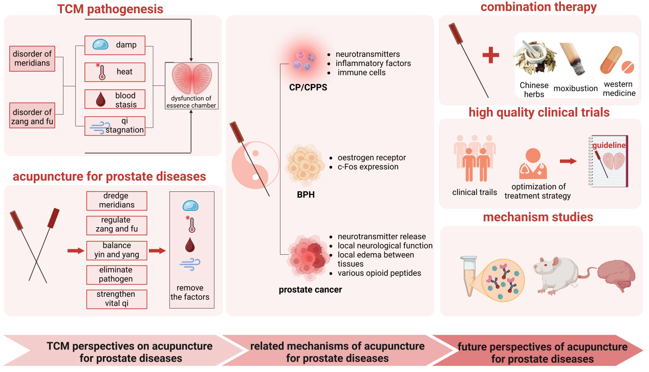 TCM views, research progress and future perspectives of
acupuncture for prostate diseases. (Created in BioRender. Wang, H. (2025)
https://BioRender.com/r35p024).
TCM: traditional Chinese medicine; CP/CPPS: chronic
prostatitis/chronic pelvic pain syndrome; BPH: benign prostatic hyperplasia.