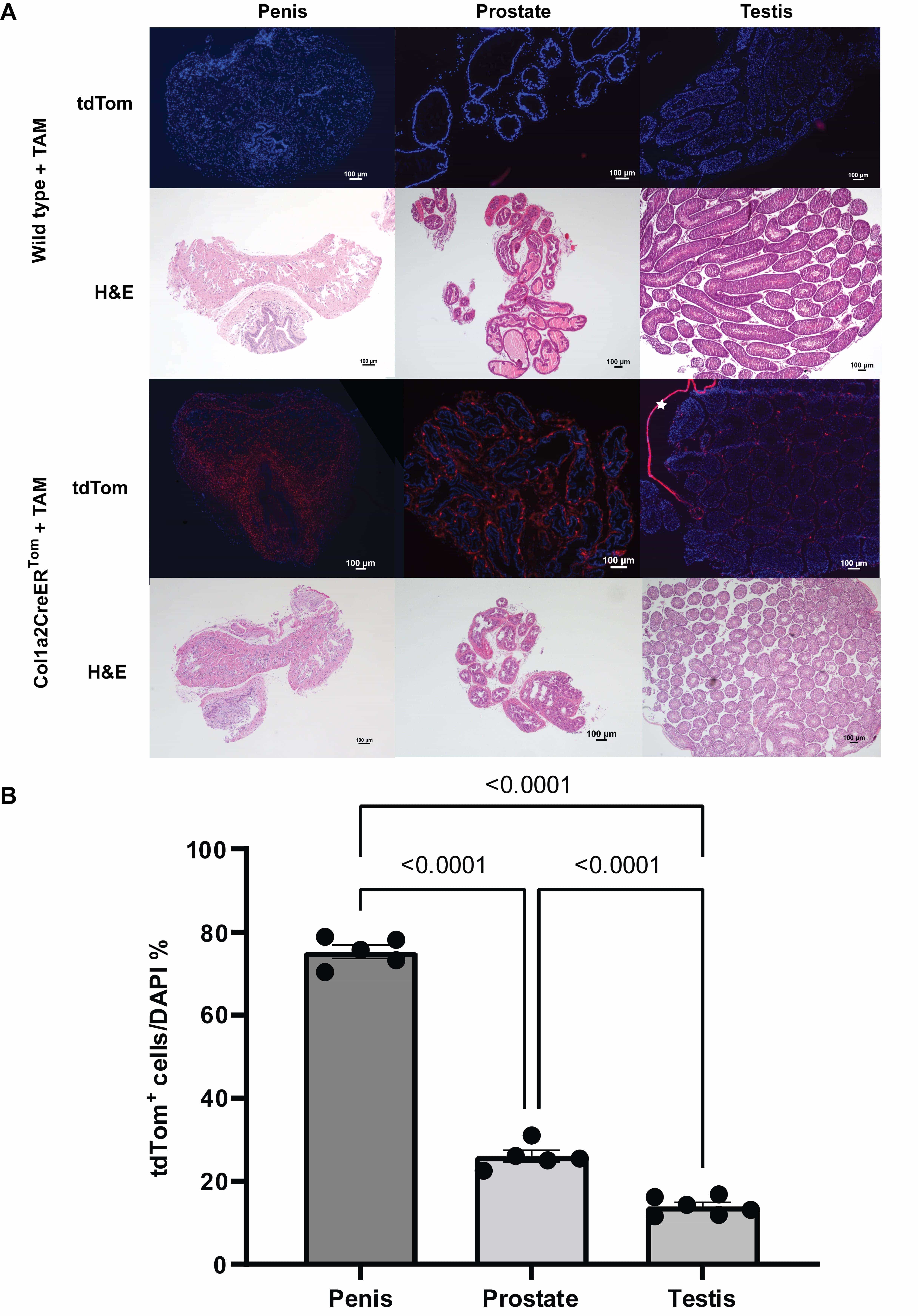 The
tdTomato+ fibroblasts in the penis, prostate, and testis of
Col1a2CreERTom mouse were efficiently labeled and tracked. (A)
Representative images of tdTomato epifluorescence and H&E. White asterisk =
tunica albuginea around the testis with tdTomato+ fibroblasts. Scale bar =
100 µm. (B) The amount of tdTomato+ fibroblasts in
Col1a2CreERTom mouse penis, prostate, and testis. Data are presented as mean
± SEM. n = 5–6 mice/group. DAPI: 4′,6-diamidino-2-phenylindole; TAM:
tamoxifen; tdTom: tandem dimer Tomato; tdTomato+: tdTomato positive; H&E:
hematoxylin and eosin; Col1a2CreERTom: collagen type I alpha 2 Cre
recombinase estrogen receptor tandem dimer Tomato. p < 0.05.