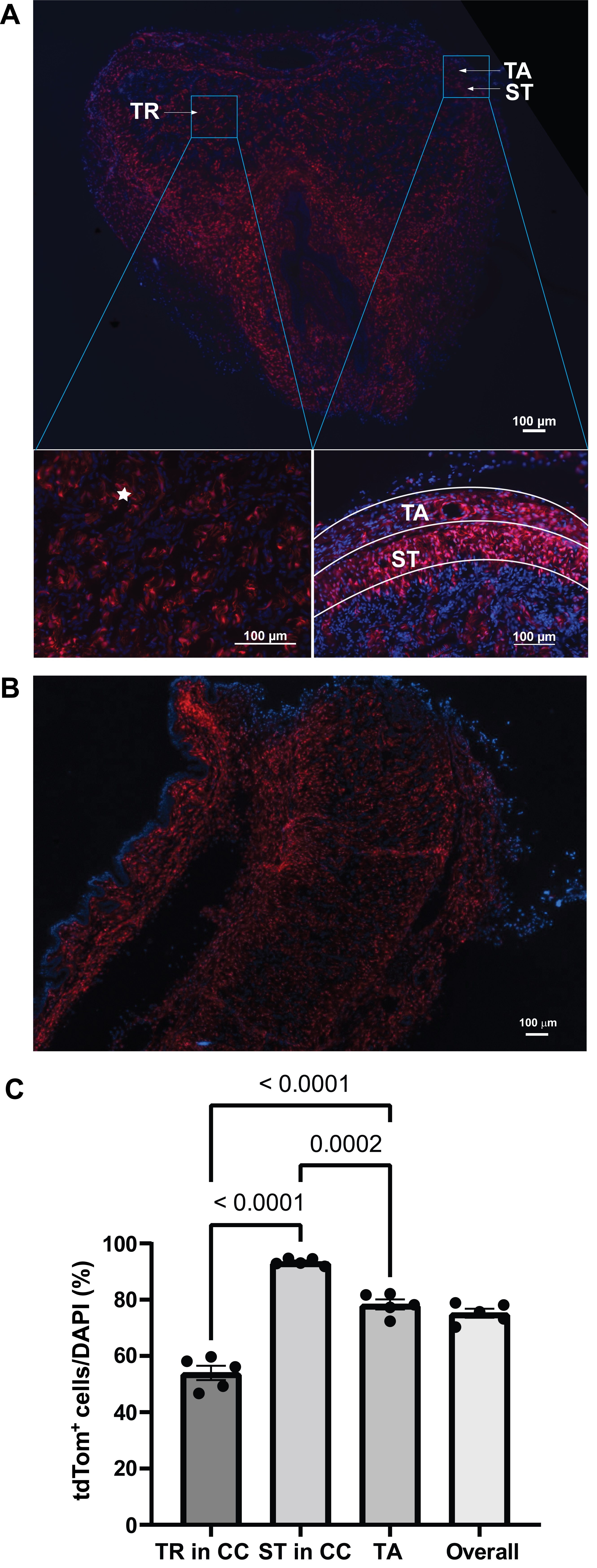 Distribution of tdTomato+ fibroblasts in both cross (A) and longitudinal (B)
sections of the Col1a2CreERTom mouse penis. (A) Cross sections showing
representative images of tdTomato epifluorescence and quantification in three
regions of penis: the tunica albuginea (TA), the subtunical (ST) and the
trabecular region (TR) in the corpora cavernosa (CC). White asterisk = sinusoids
with tdTomato+ fibroblasts. Scale bar = 100 µm. (B) Longitudinal sections of the penis. Scale bar = 100 µm. (C) tdTomato+
fibroblasts quantification in the three regions mentioned in (A). Data are
presented as mean ± SEM. n = 6 mice/group. tdTomato+: tdTomato
positive; DAPI: 4′,6-diamidino-2-phenylindole. p < 0.05.