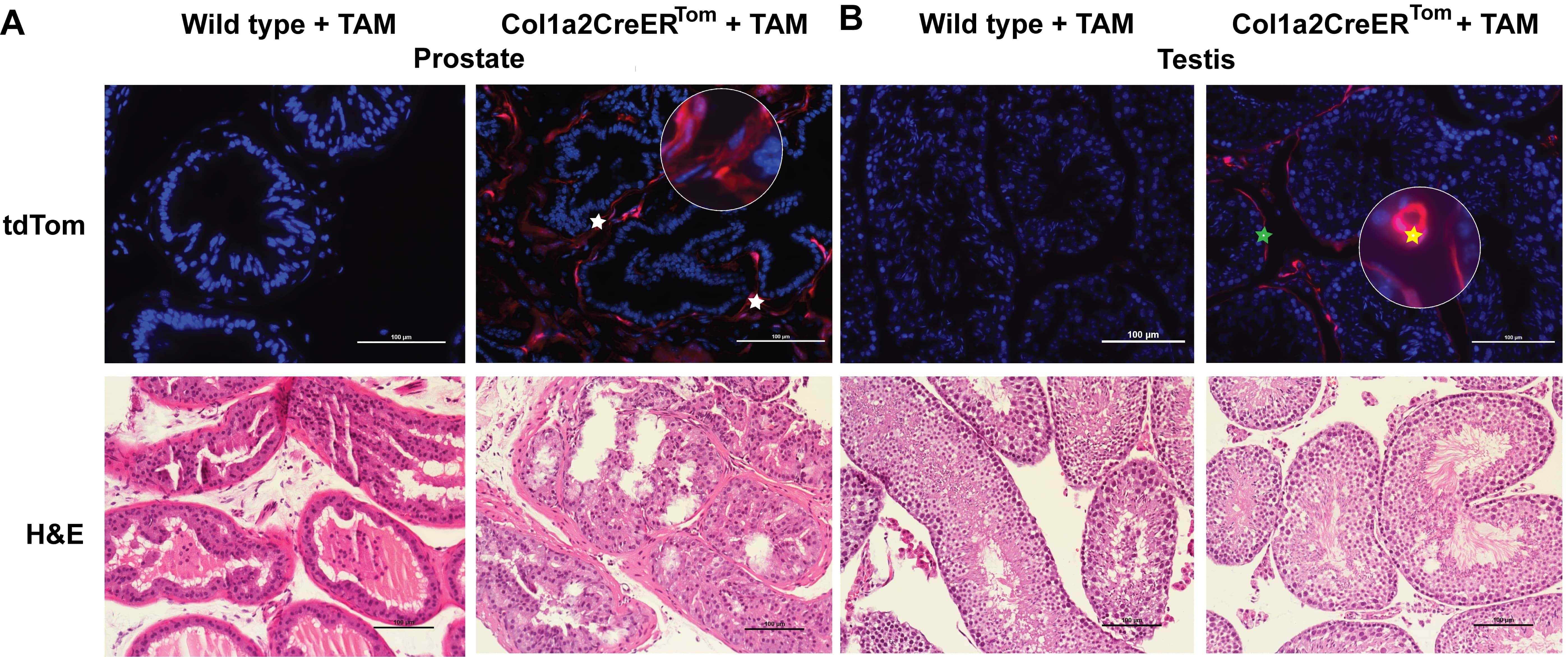 The tdTomato+ fibroblasts distribution and localization in Col1a2CreERTom mouse prostate
and testis. Representative images of tdTomato epifluorescence and H&E. (A)
Prostate. White asterisk = fibromuscular stroma with tdTomato+ fibroblasts.
(B) Testis. Yellow asterisk = basal lamina with tdTomato+ fibroblasts. Green
asterisk = individual stromal cells with tdTomato+ fibroblasts. Scale bar =
100 µm. TAM: tamoxifen; tdTom: tdTomato; H&E: hematoxylin and
eosin; Col1a2CreERTom: collagen type I alpha 2 Cre recombinase estrogen
receptor tandem dimer Tomato.