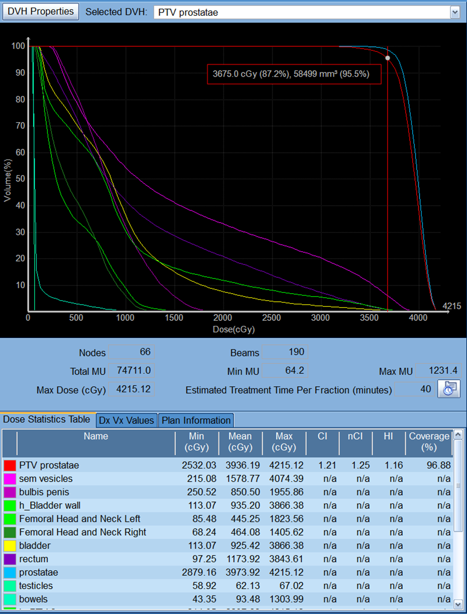Dose-volume histogram from SBRT with Cyberknife? Abbreviations:
PTV: Planning Target Volume; DVH: Dose-Volume Histogram; CI: Conformity Index;
nCI: Normalized Conformity Index; HI: Homogeneity Index.