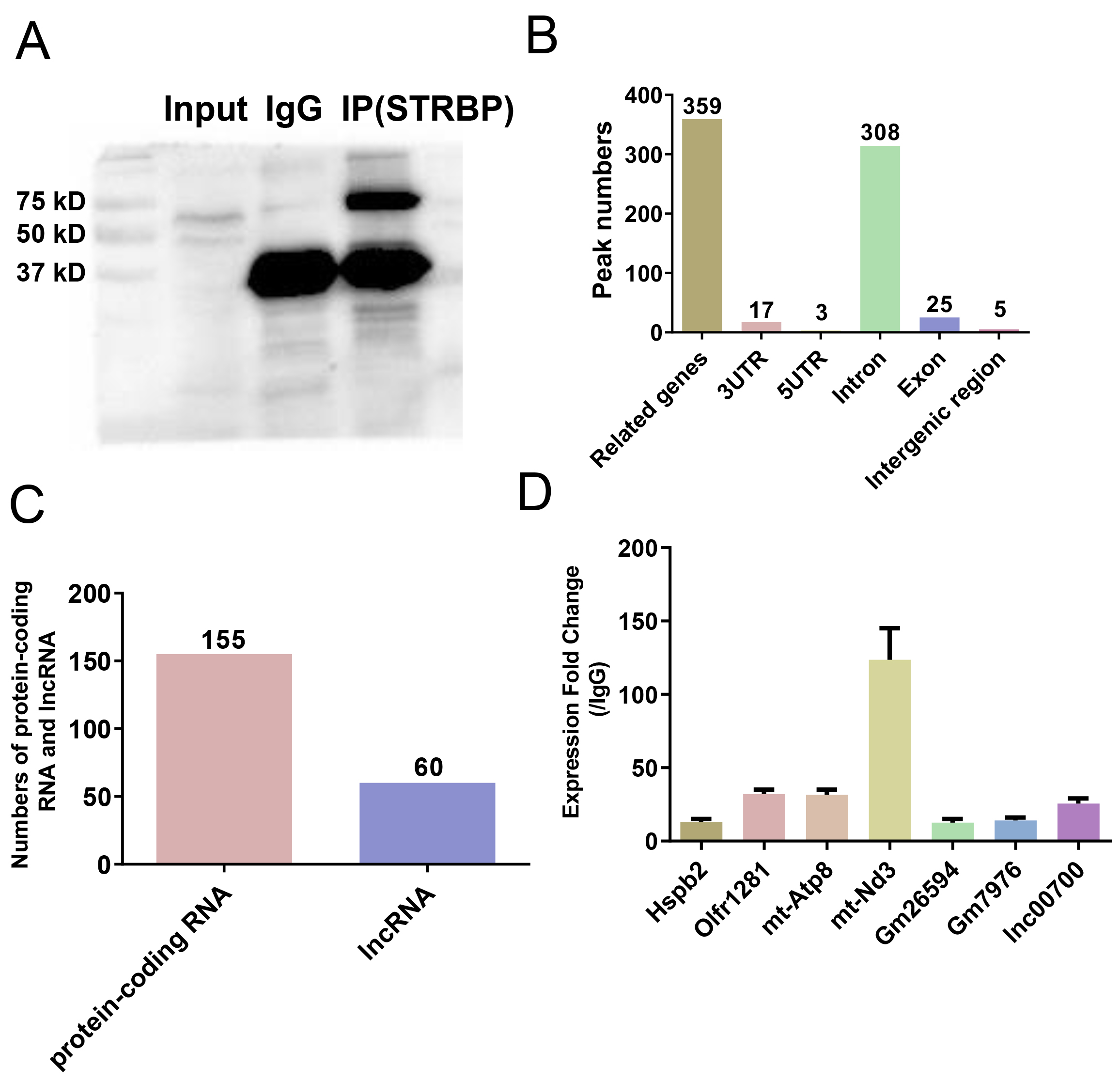 The identification and characterization of RNAs and proteins
expression in the spermatid perinuclear RNA-binding protein (STRBP) complex. (A)
RNA immune-precipitation (RIP) of STRBP. The STRBP-RNA complexes were isolated by
RIP with STRBP antibody. IgG was used as a negative control. (B) Peak-related
genes. Peak-related genes were counted on the genome and the location of the
enriched peaks in genes was analyzed. (C) Numbers of the STRBP-interacting
protein-coding RNAs and long noncoding RNAs (lncRNAs). (D) Validation of
sequencing data using quantitative PCR (qPCR). Total RNA was isolated from STRBP
complexes, and then qPCR was performed to detect the RNA expression levels. The
β-actin gene was used as a reference to normalize RNA expression
levels of desired genes. IP: immunoprecipitation; UTR: untranslated region; IgG:
immunoglobulin G.