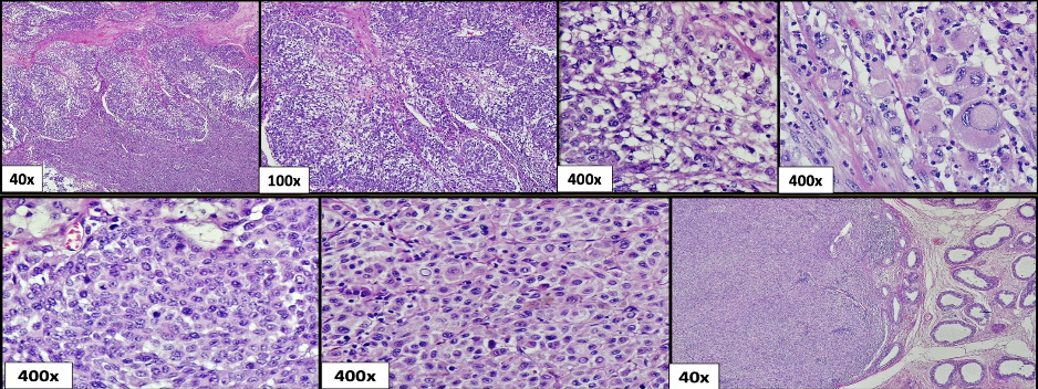 Histopathological analysis.