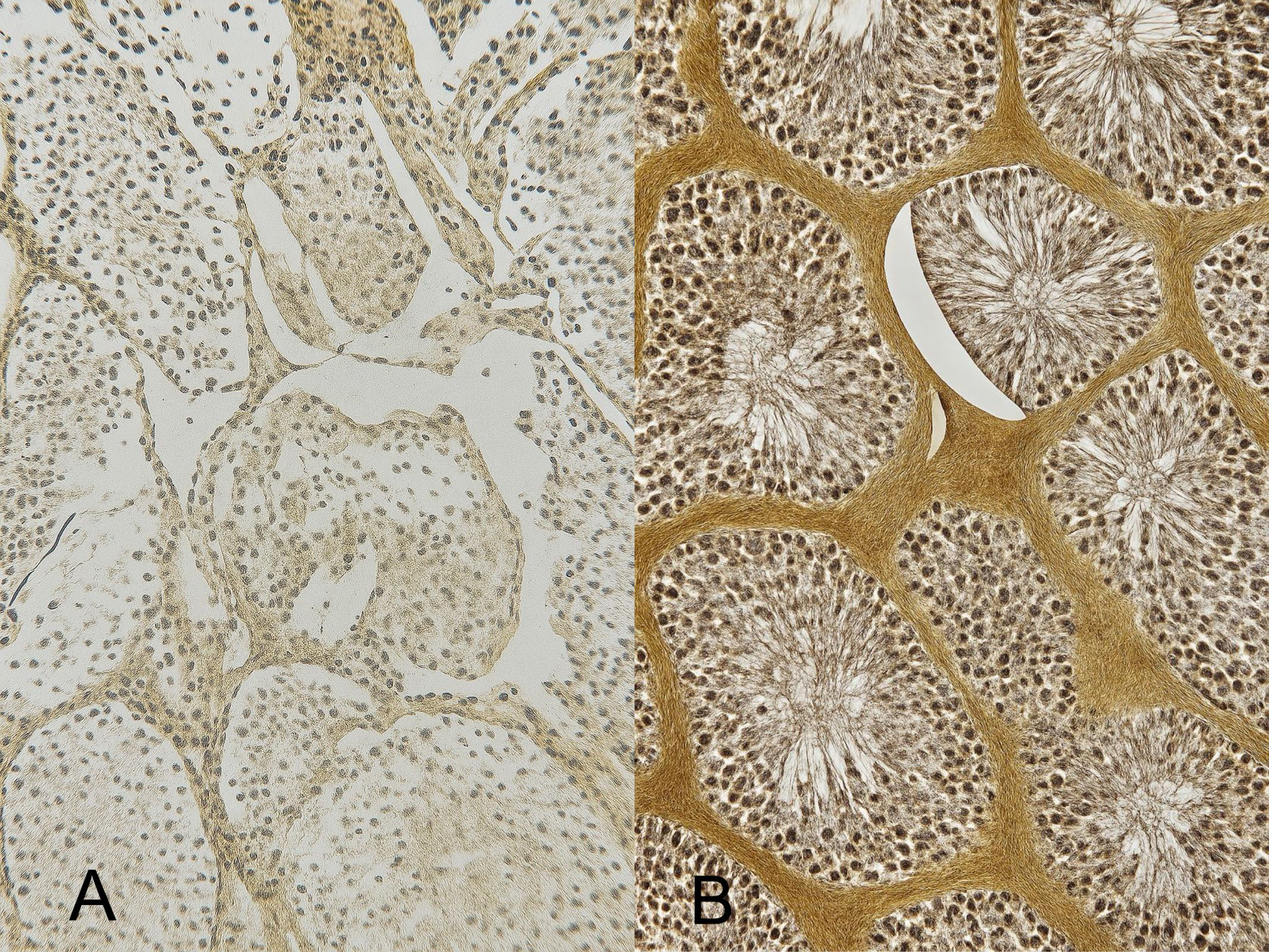 Testicular immunohistochemistry activity of NOS. (A) the
testicular tissue of the control group. (B) the testicular tissue of the soda
group.