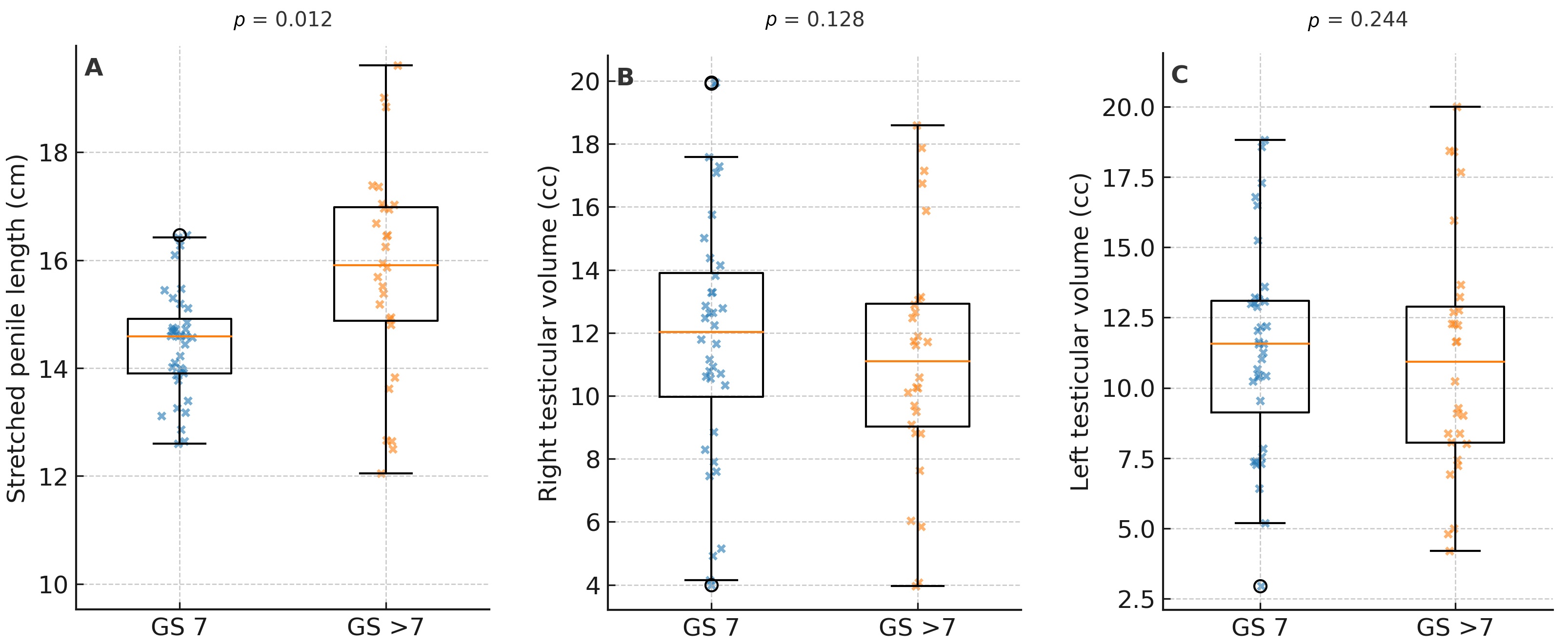 Secondary outcome—SPL and bilateral testicular volumes in men
with csPCa stratified by tumor grade. Box-and-whisker plots illustrating SPL (A)
and right (B) and left (C) testicular volumes in Caucasian men with csPCa on
prostate biopsy stratified by GS (GS 7 vs. >7). Boxes represent the
IQR, horizontal lines within boxes indicate the median, and whiskers extend to
1.5× IQR. Individual patient values are overlaid as jittered
points. p-values were calculated using the Mann-Whitney U test.
GS: Gleason Score.