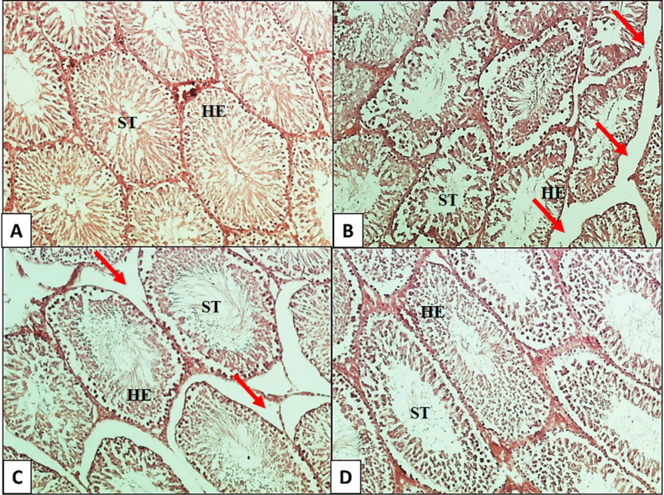 Testicular histology of adult rats following LPS administration
and Carvacrol treatment. (A) Control group showing normal seminiferous tubules
(ST) and epithelial height (HE) without oedema; (B) LPS group with markedly
reduced epithelial height with oedema. Red arrows indicate edema in testicular
tissue; (C) C25 group (LPS + Carvacrol 25 mg/kg) with near-normal epithelial
height and reduced oedema; (D) C50 group (LPS + Carvacrol 50 mg/kg) with
irregular tubular lumen but near-normal epithelial height. C: Carvacrol; LPS:
Lipopolysaccharide; C25: LPS + Carvacrol 25 mg/kg; C50: LPS + Carvacrol 50 mg/kg.
H&E. Scale bar = 50 μm.