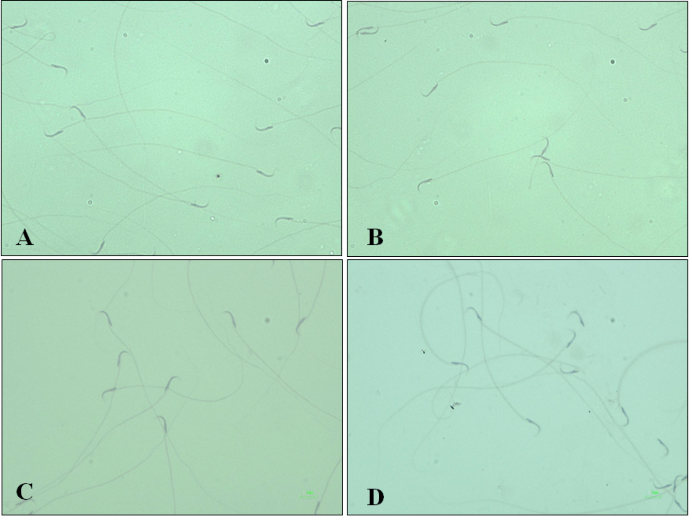Microscopic comparison of sperm morphology across experimental
groups. Representative photomicrographs illustrating sperm morphology in (A)
Control, (B) LPS, (C) C25 (LPS + Carvacrol 25 mg/kg), and (D) C50 (LPS +
Carvacrol 50 mg/kg) groups. The LPS group exhibited a significant reduction in
sperm count and increased abnormal sperm percentage, whereas carvacrol treatment
partially restored sperm count and decreased the percentage of abnormal sperm in
both C25 and C50 groups, as shown in (C) and (D). Papanicolaou staining. Scale
bars = 10 μm.