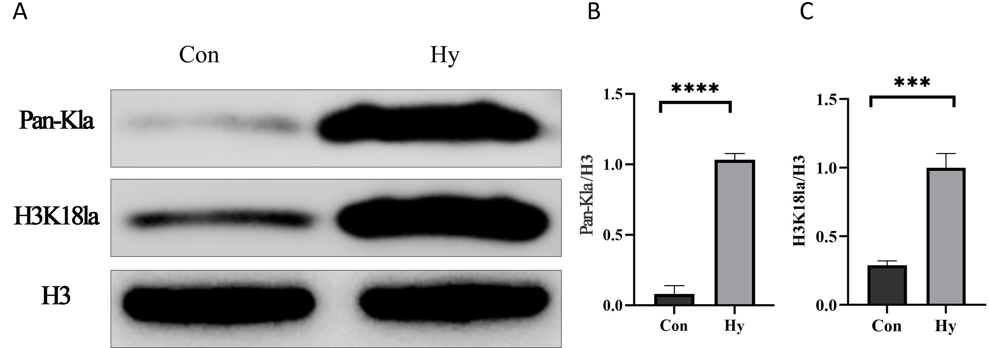 Western blot analysis of histone lactylation in GC-1 cells under
normoxia and hypoxia. Data are presented as mean ± SD (n = 3). (A) western
blot images showing protein levels of H3K18la and Pan-Kla. (B) Pan-Kla protein
expression levels. (C) H3K18la protein expression levels. Hypoxia significantly
increased global histone lactylation (Pan-Kla) and H3K18la compared with
normoxia, indicating enhanced lactylation in response to low oxygen tension.
***p < 0.001; ****p < 0.0001. Con, normoxia group; Hy,
hypoxia group; H3K18la, histone H3 lysine 18 lactylation;
Pan-Kla, pan lysine lactylation.