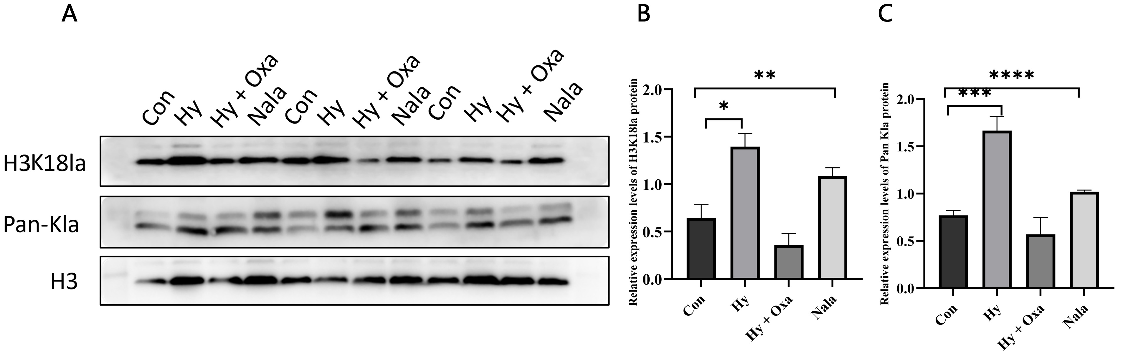 WB analysis of Pan-Kla and H3K18la levels in
GC-1 cells under different treatments. Data are presented as mean ± SD (n
= 3). (A) western blot images showing protein levels of H3K18la and Pan-Kla. (B)
H3K18la protein expression levels. (C) Pan-Kla protein expression levels. The Con
group showed low expression, whereas the Hy group exhibited a marked increase in
Pan-Kla and H3K18la. Treatment with sodium oxamate (Hy + Oxa group) significantly
reduced lactylation levels compared with Hy, while exogenous lactate (Nala)
restored levels comparable to Hy. Con, normoxia group; Hy, hypoxia group; Hy +
Oxa, hypoxia + sodium oxamate; Nala,
L-lactate treatment; H3K18la, histone H3
lysine 18 lactylation; Pan-Kla, pan lysine lactylation. *p < 0.05;
**p < 0.01; ***p < 0.001; ****p < 0.0001.