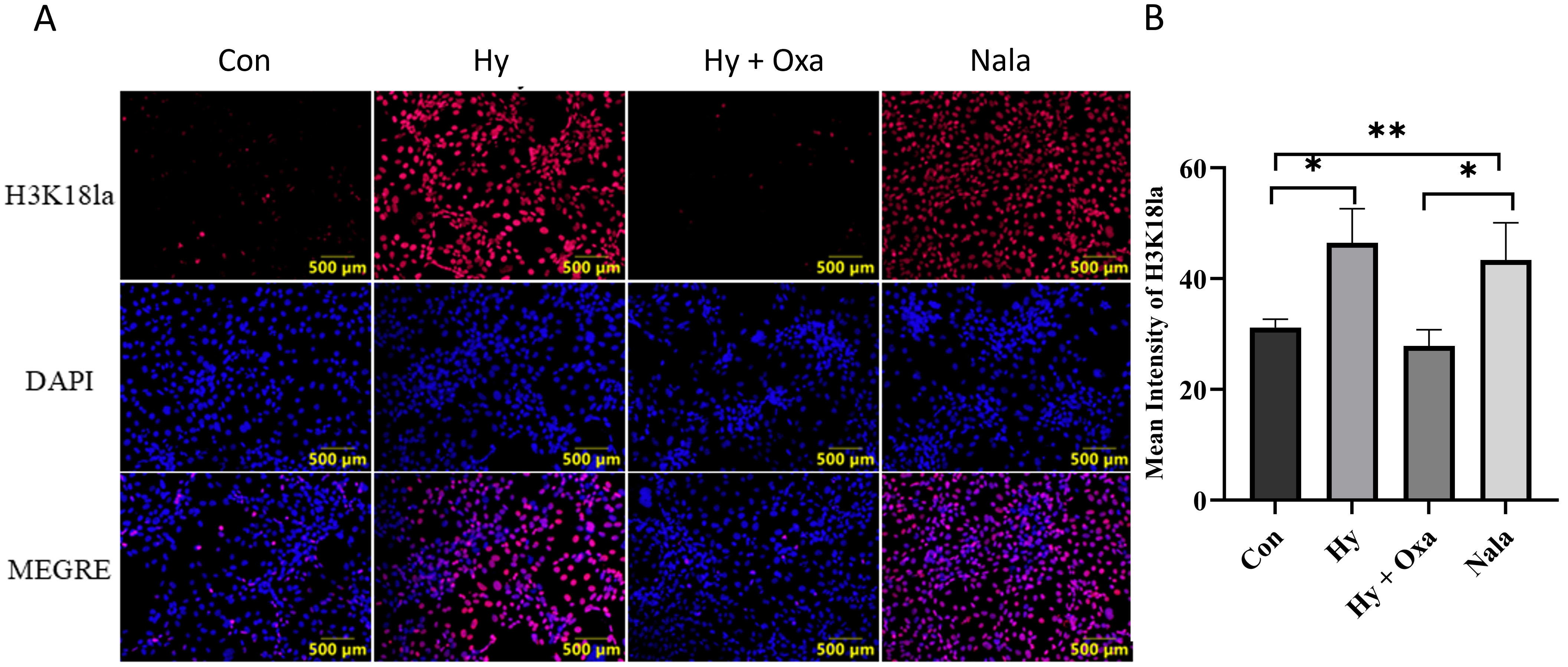 Immunofluorescence analysis of H3K18la
expression and quantification in GC-1 cells under different treatments. (A)
Representative immunofluorescence images showing H3K18la expression with DAPI
nuclear staining. Scale bar: 500 μm. (B) Quantitative analysis of H3K18la
fluorescence intensity. Data are presented as mean ± SD (n = 3).
Fluorescence intensity was significantly increased in the Hy group compared with
Con, suppressed by sodium oxamate (*p < 0.05), and elevated again by
exogenous lactate relative to Con. *p < 0.05; **p < 0.01.
Con, normoxia group; Hy, hypoxia group; Hy + Oxa, hypoxia + sodium oxamate; Nala,
L-lactate treatment; H3K18la, histone H3 lysine 18 lactylation; DAPI,
4′,6-diamidino-2-phenylindole; MERGE, merged images.