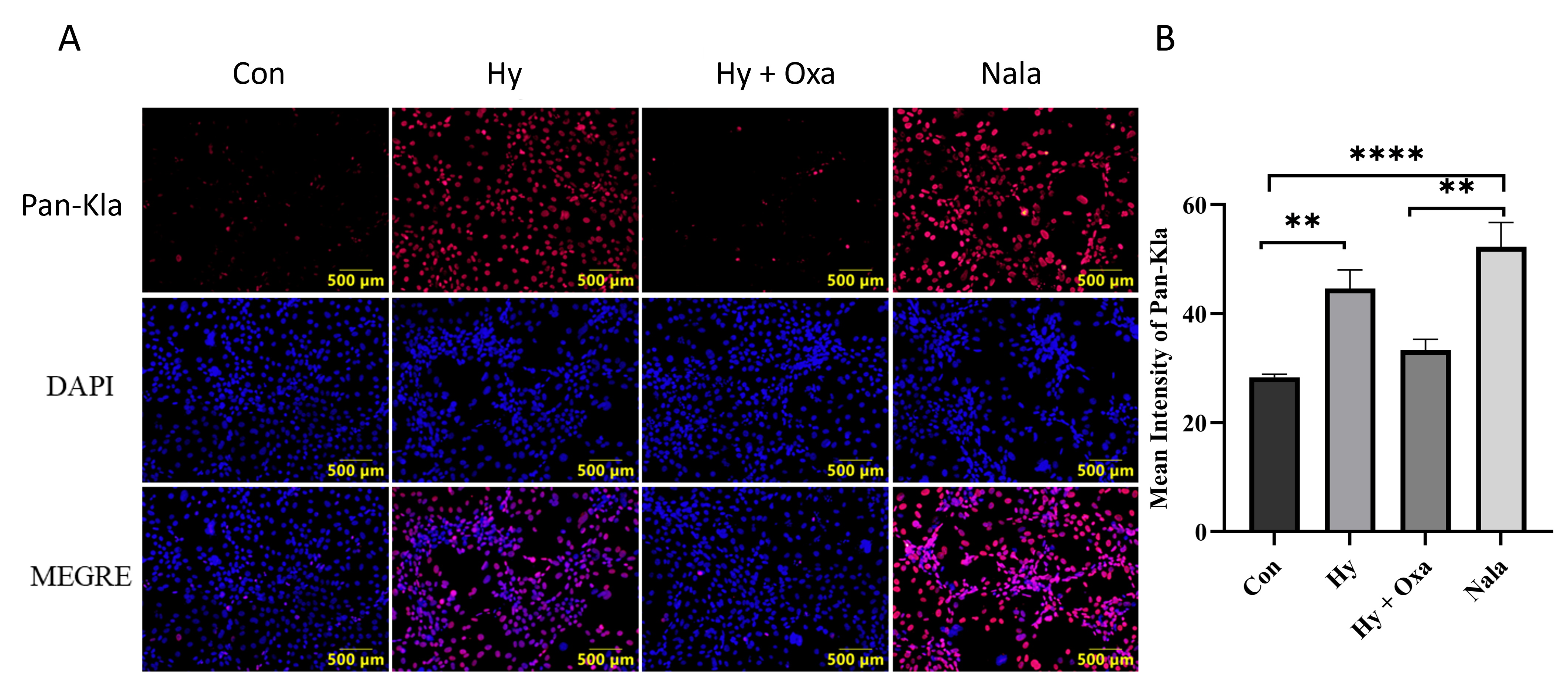 Immunofluorescence analysis of Pan-Kla expression and
quantification in GC-1 cells under different treatments. (A) Representative
immunofluorescence images showing Pan-Kla expression with DAPI nuclear staining
and merged images. Scale bar: 500 μm. (B) Quantitative analysis of Pan-Kla
fluorescence intensity. Data are presented as mean ± SD (n = 3). Compared
with Con, Pan-Kla fluorescence intensity was significantly elevated in the Hy
group and reduced in the Hy + Oxa group compared with Hy. Nala treatment induced
higher Pan-Kla expression than Hy + Oxa. Con, normoxia group; Hy, hypoxia group;
Hy + Oxa, hypoxia + sodium oxamate; Nala, normoxia + L-lactate; Nala, L-lactate
treatment; Pan-Kla, pan lysine lactylation; DAPI,
4′,6-diamidino-2-phenylindole; MERGE, merged images. **p < 0.01;
****p < 0.0001.