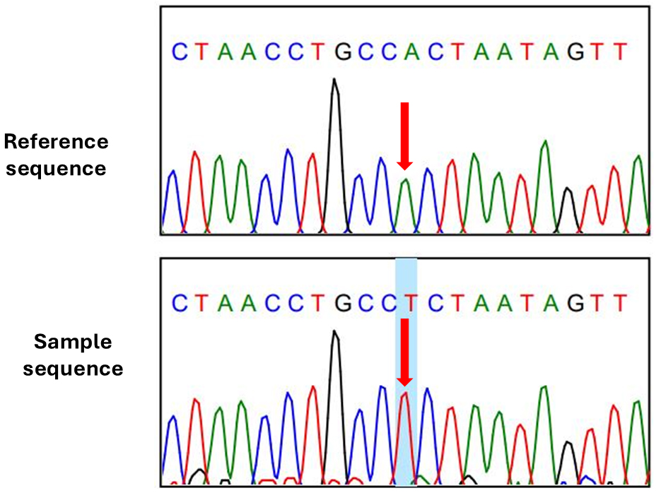 Sequence chromatogram of a
novel variant at position M.10313 A>T, the wild type in the upper panel and the
novel variant in the lower panel.