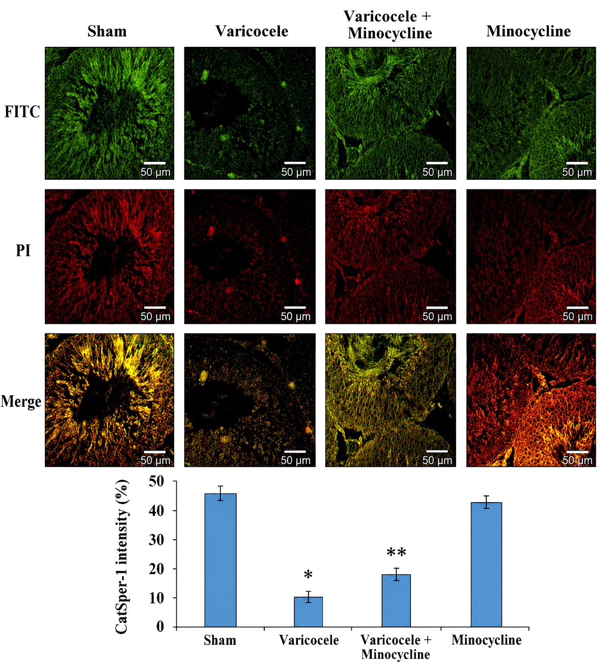 Immunohistochemistry of Catsper-1 in study groups. Scale bars
(50 μm) and magnification (×400). *p < 0.05
vs. Sham group; **p < 0.05 vs. Varicocele group.
FITC: Fluorescein Isothiocyanate; PI: Propidium Iodide.