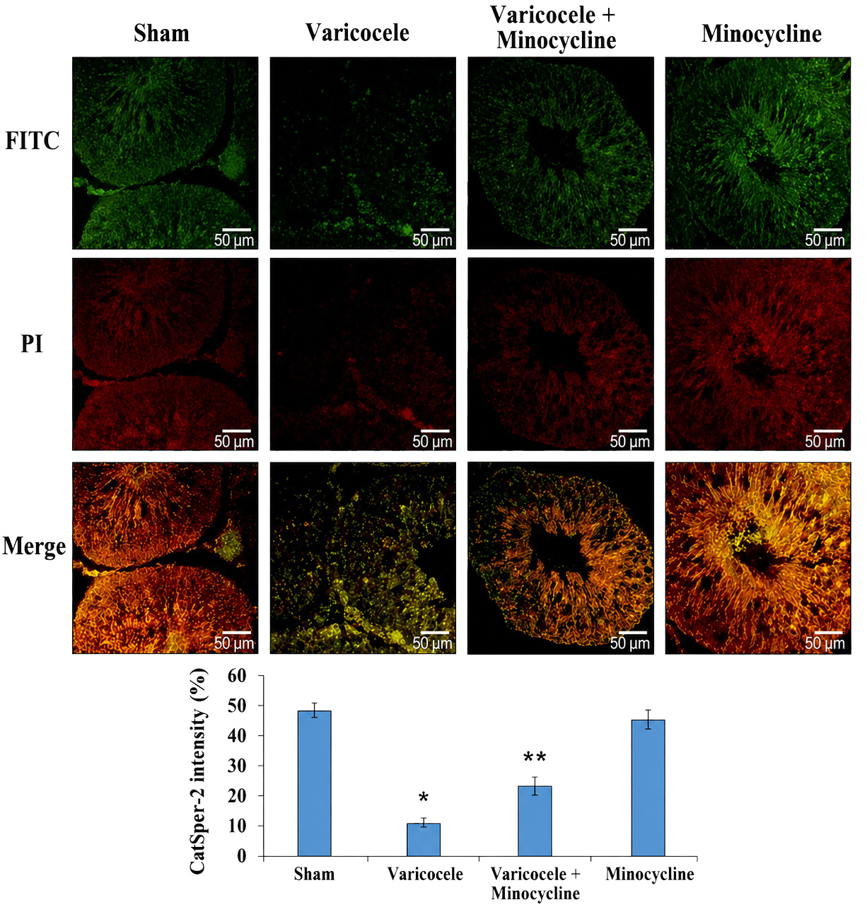 Immunohistochemistry of Catsper-2 in study groups. Scale bars
(50 μm) and magnification (×400). *p < 0.05
vs. Sham group; **p < 0.05 vs. Varicocele group.
FITC: Fluorescein Isothiocyanate; PI: Propidium Iodide.